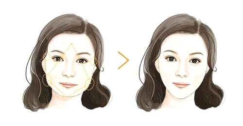 瘦脸针的危害有什么副作用,打瘦脸针的三大副作用